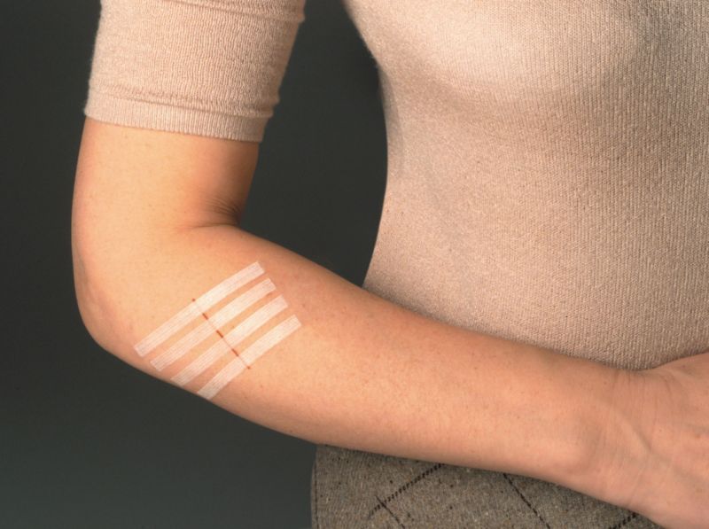 Paski do zamykania ran Viscoplast Steri-Strip białe 2 rozmiary 8 szt. w pudełku, 12 pudełek w zestawie
